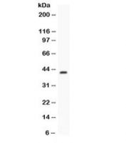 Western blot testing of mouse spleen lysate with Factor D antibody. Predicted molecular weight ~27 kDa, observed here at ~43 kDa.