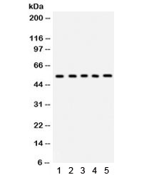 Western blot testing of 1) rat liver, 2) rat lung, 3) human HepG2, 4) HeLa and 5) HEPA lysate with Vitronectin antibody. Expected/observed molecular weight ~54 kDa.~
