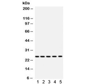 Western blot testing of mouse 1) testis, 2) lung, 3) heart, 4) liver and 5) human HepG2 lysate with SOD2 antibody. Expected/observed molecular weight ~25 kDa.