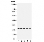 Western blot testing of mouse 1) testis, 2) lung, 3) heart, 4) liver and 5) human HepG2 lysate with SOD2 antibody. Expected molecular weight ~25 kDa.