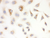 ICC testing of FFPE human A549 cells with SOD2 antibody. HIER: steam section in pH6 citrate buffer for 20 min and allow to cool prior to testing.