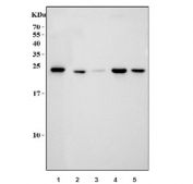 Western blot testing of mouse 1) human HepG2, 2) rat liver, 3) rat lung, 4) mouse liver and 5) mouse lung lysate with SOD2 antibody. Expected molecular weight ~25 kDa.