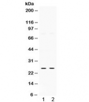 Western blot testing of human 1) HeLa and 2) SMMC cell lysate with Thymidine kinase 1 antibody. Expected/observed molecular weight ~25 kDa.