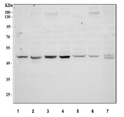 Western blot testing of human COLO320 cell lysate with WNT1 antibody. Expected/observed molecular weight ~41 kDa.