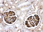 IHC testing of FFPE rat kidney with Apolipoprotein A I antibody. HIER: Boil the paraffin sections in pH 6, 10mM citrate buffer for 20 minutes and allow to cool prior to staining.