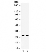 Western blot testing of 1) rat liver and 2) rat testis lysate with Apolipoprotein A I antibody. Predicted molecular weight ~30 kDa.