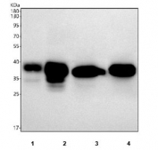 Western blot testing of 1) human HCCT, 2) human HCCP, 3) rat liver and 4) mouse liver tissue lysate with Arginase antibody. Expected weight ~35 kDa.