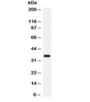 Western blot testing of rat liver lysate with Arginase antibody. Expected/observed molecular weight ~35 kDa.