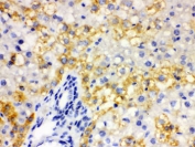 IHC testing of FFPE rat liver tissue with ALDH2 antibody. HIER: Boil the paraffin sections in pH 6, 10mM citrate buffer for 20 minutes and allow to cool prior to staining.
