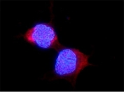 Immunofluorescent staining of FFPE human U-2 OS cells with ALDH2 antibody (red) and DAPI nuclear stain (blue). HIER: steam section in pH6 citrate buffer for 20 min.