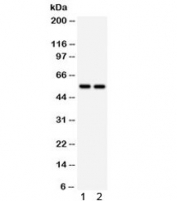 Western blot testing of 1) rat kidney and 2) mouse kidney lysate with ALDH2 antibody. Predicted/observed molecular weight ~56 kDa.