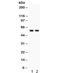 Western blot testing of 1) rat liver and 2) mouse liver lysate with CYP1A2 antibody. Predicted/observed molecular weight: ~58 kDa.