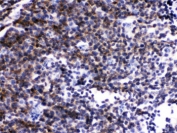 IHC testing of FFPE mouse lymph node with LCK antibody. HIER: Boil the paraffin sections in pH 6, 10mM citrate buffer for 20 minutes and allow to cool prior to staining.
