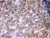 IHC testing of FFPE human tonsil with LCK antibody. HIER: Boil the paraffin sections in pH 6, 10mM citrate buffer for 20 minutes and allow to cool prior to staining.