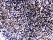 IHC testing of FFPE rat lymph node with LCK antibody. HIER: Boil the paraffin sections in pH 6, 10mM citrate buffer for 20 minutes and allow to cool prior to staining.