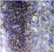 IHC staining of frozen mouse spleen tissue with LCK antibody.