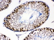 IHC testing of FFPE mouse testis with CDK1 antibody. HIER: Boil the paraffin sections in pH 6, 10mM citrate buffer for 20 minutes and allow to cool prior to staining.