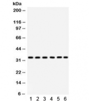 Western blot testing of 1) rat thymus, 2) rat spleen, 3) human MCF7, 4) HeLa, 5) Jurkat, and 6) mouse NIH3T3 lysate with CDK1 antibody. Predicted/observed molecular weight: ~33 kDa.
