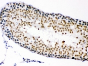 IHC testing of FFPE rat testis with CDK1 antibody. HIER: Boil the paraffin sections in pH 6, 10mM citrate buffer for 20 minutes and allow to cool prior to staining.