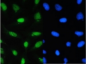IF/ICC staining of FFPE human U-2 OS cells with CDK1 antibody (green) at 2ug/ml and DAPI nuclear stain (blue). HIER: steam section in pH6 citrate buffer for 20 min.