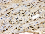 IHC testing of FFPE human appendicitis tissue with S100A9 antibody. HIER: Boil the paraffin sections in pH 6, 10mM citrate buffer for 20 minutes and allow to cool prior to staining.