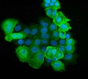 Immunofluorescent staining of FFPE human A431 cells with S100A6 antibody (green) and DAPI nuclear stain (blue). HIER: steam section in pH6 citrate buffer for 20 min.