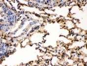 IHC testing of FFPE rat lung with S100A6 antibody. HIER: Boil the paraffin sections in pH 6, 10mM citrate buffer for 20 minutes and allow to cool prior to staining.