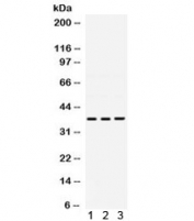 Western blot testing of human 1) HeLa, 2) Jurkat and 3) SMMC lysate with DNA polymerase beta antibody. Expected/observed molecular weight ~38 kDa.