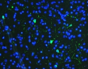Immunofluorescent staining of FFPE rat brain tissue with Tyrosine Hydroxylase antibody (green) and DAPI nuclear stain (blue). HIER: steam section in pH8 EDTA buffer for 20 min.