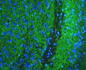 Immunofluorescent staining of FFPE mouse brain tissue with Tyrosine Hydroxylase antibody (green) and DAPI nuclear stain (blue). HIER: steam section in pH8 EDTA buffer for 20 min.
