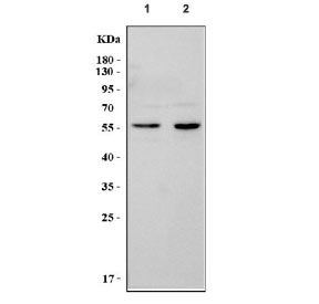 Western blot testing of 1) rat brain and 2) mouse brain lysate with Tyrosine Hydroxylase antibody. Expected molecular weight 55~60 kDa.