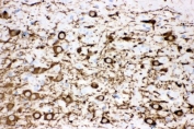 IHC testing of FFPE mouse brain with Tyrosine Hydroxylase antibody. HIER: Boil the paraffin sections in pH8 EDTA buffer for 20 minutes and allow to cool prior to staining.