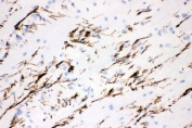 IHC testing of FFPE rat brain with Tyrosine Hydroxylase antibody. HIER: Boil the paraffin sections in pH8 EDTA buffer for 20 minutes and allow to cool prior to staining.