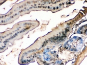 IHC testing of FFPE mouse intestine with FABP antibody. HIER: Boil the paraffin sections in pH 6, 10mM citrate buffer for 20 minutes and allow to cool prior to staining.
