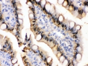 IHC testing of FFPE rat intestine with FABP antibody. HIER: Boil the paraffin sections in pH 6, 10mM citrate buffer for 20 minutes and allow to cool prior to staining.