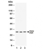 Western blot testing of human 1) HepG2, 2) A549 and 3) PANC cell lysate with Cathepsin D antibody. Expected molecular weight: 43-46 kDa, 28 kDa (heavy chain), 15 kDa (light chain).