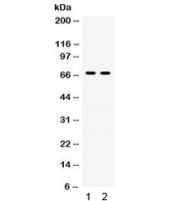 Western blot testing of human 1) A431 and 2) A549 lysate with Involucrin antibody. Predicted molecular weight ~68 kDa but can be observed at up to ~140 kDa.