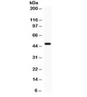 Western blot testing of rat brain lysate with ADRB2 antibody. Predicted molecular weight ~46 kDa, but commonly observed at up to 85 kDa.