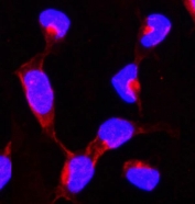 Immunofluorescent staining of FFPE human U-2 OS cells with HSP90 alpha antibody (red) and DAPI nuclear stain (blue). HIER: steam section in pH6 citrate buffer for 20 min.