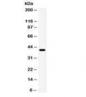 Western blot testing of K562 cell lysate with CD55 antibody. Observed molecular weight: 41~70 kDa depending on glycosylation level.
