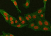 Immunofluorescent staining of FFPE human U-2 OS cells with MR antibody (red) and Alpha Tubulin mAb (green). HIER: steam section in pH6 citrate buffer for 20 min.