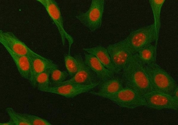 Immunofluorescent staining of FFPE human