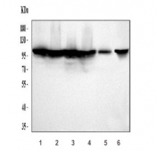 Western blot testing of 1) huma HeLa, 2) human 293T, 3) human LNCaP, 4) human MCF7, 5) rat NRK and 6) mouse NIH 3T3 cell lysate with MR antibody. Expected molecular weight ~107/108/94 kDa (isoforms 1/3/4).