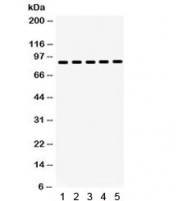 Western blot testing of 1) rat testis, 2) rat thymus, 3) human placenta, 4) SW620 and 5) HeLa lysate with HSP90 beta antibody. Expected/observed molecular weight: 84-90 kDa.
