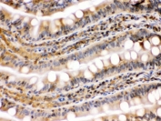 IHC testing of FFPE rat testis with HSP90 beta antibody. HIER: Boil the paraffin sections in pH 6, 10mM citrate buffer for 20 minutes and allow to cool prior to staining.