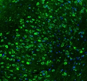 Immunofluorescent staining of mouse brain with HSP90 beta antibody (green) at 2ug/ml and DAPI nuclear counterstain. HIER: Boil the paraffin sections in pH 6, 10mM citrate buffer for 20 minutes and allow to cool prior to staining.