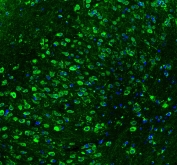 Immunofluorescent staining of mouse brain with HSP90 beta antibody (green) at 2ug/ml and DAPI nuclear counterstain. HIER: Boil the paraffin sections in pH 6, 10mM citrate buffer for 20 minutes and allow to cool prior to staining.