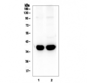 Western blot testing of 1) rat brain and 2) mouse brain lysate with Synaptophysin antibody. Predicted/observed molecular weight: 34~38 kDa.