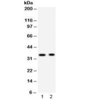 Western blot testing of 1) rat brain and 2) mouse brain lysate with Synaptophysin antibody. Predicted/observed molecular weight: 34~38 kDa.