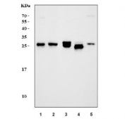 Western blot testing of 1) human HCCT, 2) human HCCP, 3) rat liver, 4) rat RH35 and 5) mouse liver tissue lysate with GSTA antibody. Predicted molecular weight ~25 kDa.